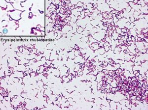 Erysipelothrix rhusiopathiae gram stain. Versalovic et al., 2011. 